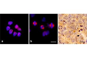 Immunocytochemistry of TPX2 using monoclonal antibody TPX2-01 in glioblastoma cell line T98G: a) interphase, b) mitosis. (TPX2 anticorps)
