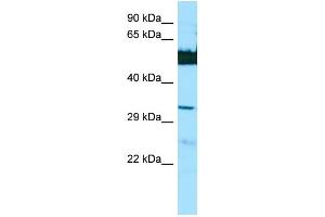 WB Suggested Anti-LGSN Antibody Titration: 1. (LGSN anticorps  (N-Term))