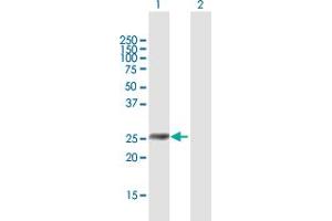 Western Blot analysis of IGFBP6 expression in transfected 293T cell line by IGFBP6 MaxPab polyclonal antibody. (IGFBP6 anticorps  (AA 1-240))