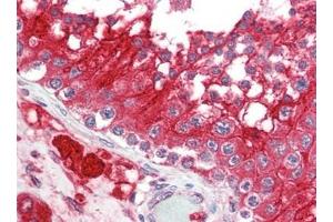 Human Testis (formalin-fixed, paraffin-embedded) stained with ACE2at 2. (ACE2 anticorps  (N-Term))
