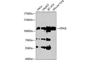 Western blot analysis of extracts of various cell lines, using ITPKB antibody (ABIN1680537, ABIN3018302, ABIN3018303 and ABIN6220431) at 1:1000 dilution. (ITPKB anticorps  (AA 1-260))