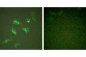PMA + -Immunofluorescence analysis of HeLa cells, treated with PMA (125ng/ml, 30mins), using 14-3-3 ζ (Ab-58) antibody (#B0001). (14-3-3 zeta anticorps  (Ser58))