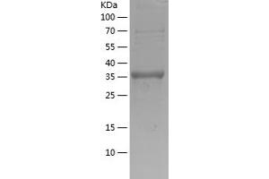 Growth Differentiation Factor 5 (GDF5) (AA 382-501) protein (His-IF2DI Tag)
