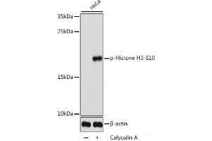 Western blot analysis of extracts of HeLa cells using Phospho-Histone H3(S10) Polyclonal Antibody at dilution of 1:1000. (Histone 3 anticorps  (pSer10))
