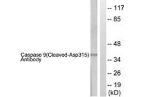 Western blot analysis of extracts from 293 cells, treated with Etoposide 25uM 60', using Caspase 9 (Cleaved-Asp315) Antibody. (Caspase 9 anticorps  (Cleaved-Asp315))