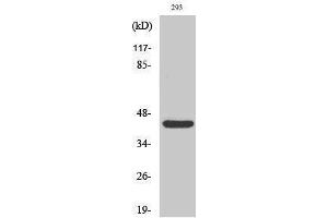 Western Blotting (WB) image for anti-RAD52 Homolog (S. Cerevisiae) (RAD52) (Thr56) antibody (ABIN3177110) (RAD52 anticorps  (Thr56))