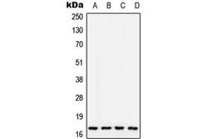 Western blot analysis of COX5A expression in MCF7 (A), SP2/0 (B), PC12 (C), Human liver (D) whole cell lysates. (COX5A anticorps  (Center))