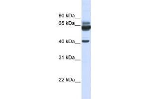 Western Blotting (WB) image for anti-Par-6 Partitioning Defective 6 Homolog beta (PARD6B) antibody (ABIN2458688) (PARD6B anticorps)