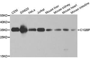 Western blot analysis of extracts of various cell lines, using C1QBP antibody. (C1QBP anticorps)