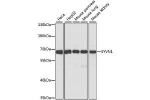 Western blot analysis of extracts of various cell lines, using SYVN1 antibody (ABIN1875011) at 1:1000 dilution. (SYVN1 anticorps)