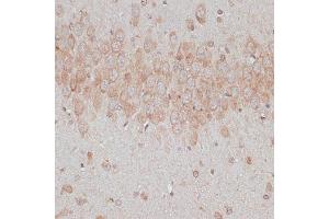 Immunohistochemistry of paraffin-embedded rat brain using TMX1 antibody  at dilution of 1:100 (40x lens).