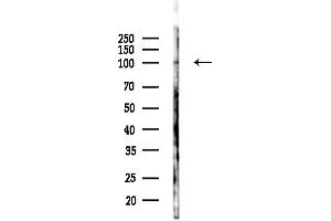 anti-Discs, Large (Drosophila) Homolog-Associated Protein 5 (DLGAP5) (N-Term) antibody