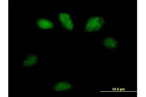 Immunofluorescence of purified MaxPab antibody to GSTO2 on HeLa cell.