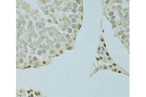 Immunohistochemistry of paraffin-embedded Rat testis using SAFB Polyclonal Antibody at dilution of 1:100 (40x lens).