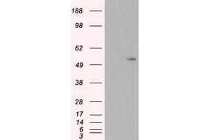 Image no. 7 for anti-Myc Proto-Oncogene protein (MYC) antibody (ABIN1497012) (c-MYC anticorps)