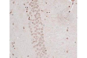Immunohistochemistry of paraffin-embedded Mouse brain using ZNF177 Polyclonal Antibody at dilution of 1:100 (40x lens). (ZNF177 anticorps)
