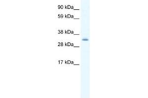 Western Blot showing PDLIM1 antibody used at a concentration of 1-2 ug/ml to detect its target protein. (PDLIM1 anticorps  (Middle Region))