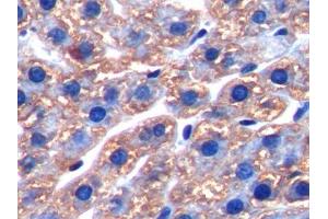 IHC-P analysis of Rat Liver Tissue, with DAB staining. (FTH1 anticorps  (AA 1-182))