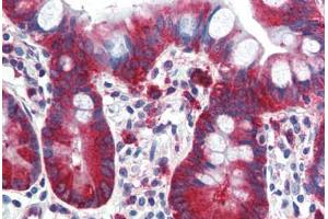 Human Small Intestine (formalin-fixed, paraffin-embedded) stained with TPD52L1 antibody ABIN364314 at 5 ug/ml followed by biotinylated anti-mouse IgG secondary antibody ABIN481714, alkaline phosphatase-streptavidin and chromogen. (TPD52L1 anticorps)