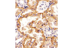 (ABIN6242877 and ABIN6578324) staining SLC22A2 in human kidney tissue sections by Immunohistochemistry (IHC-P - paraformaldehyde-fixed, paraffin-embedded sections). (SLC22A2 anticorps  (N-Term))