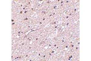 Immunohistochemistry of HAP1 in human brain tissue with HAP1 antibody at 2.