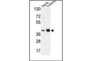 Western blot analysis of NDUFA10 Antibody (Center) in HepG2 cell line and mouse kidney tissue lysates (35ug/lane). (NDUFA10 anticorps  (Middle Region))