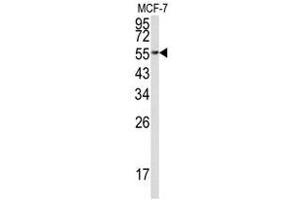 Image no. 1 for anti-Eukaryotic Translation Elongation Factor 1 alpha 1 (EEF1A1) (C-Term) antibody (ABIN452935) (eEF1A1 anticorps  (C-Term))