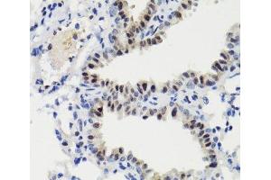Immunohistochemistry of paraffin-embedded Mouse lung using Phospho-Stat3(S727) Polyclonal Antibody at dilution of 1:100 (40x lens).