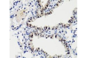 Immunohistochemistry of paraffin-embedded Mouse lung using Phospho-Stat3(S727) Polyclonal Antibody at dilution of 1:100 (40x lens). (STAT3 anticorps  (pSer727))