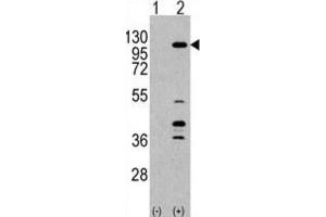 Western Blotting (WB) image for anti-Phosphoinositide-3-Kinase, Catalytic, gamma Polypeptide (PIK3CG) antibody (ABIN3003740) (PIK3 gamma anticorps)