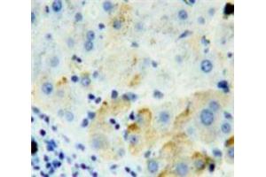 Used in DAB staining on fromalin fixed paraffin-embedded Liver tissue (FURIN anticorps  (AA 587-748))