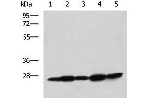 Western blot analysis of Mouse liver tissue Mouse brain tissue Rat brain tissue Rat liver tissue and Human fetal liver tissue lysates using QDPR Polyclonal Antibody at dilution of 1:800 (QDPR anticorps)