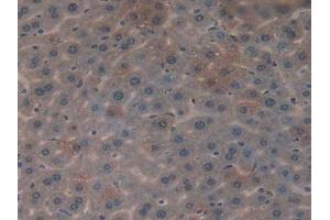 Figure. (CYR61 anticorps  (AA 176-379))