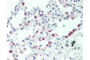 Anti-CYP2B6 antibody IHC staining of human lung. (CYP2B6 anticorps  (AA 235-263))