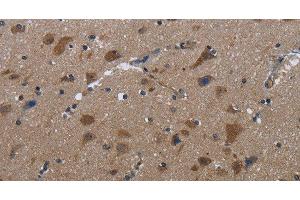 Immunohistochemistry of paraffin-embedded Human brain tissue using LETMD1 Polyclonal Antibody at dilution 1:30 (LETMD1 anticorps)