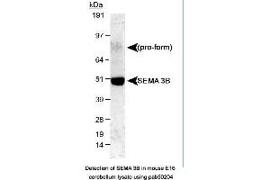 Image no. 1 for anti-Sema Domain, Immunoglobulin Domain (Ig), Short Basic Domain, Secreted, (Semaphorin) 3B (SEMA3B) (AA 100-200) antibody (ABIN363513) (SEMA3B anticorps  (AA 100-200))