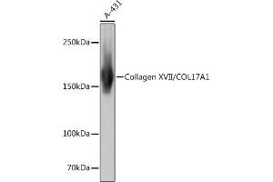 Western blot analysis of extracts of A-431 cells, using Collagen XVII/COL17 Rabbit mAb (ABIN7266467) at 1:1000 dilution.