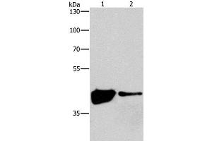 Western Blot analysis of 293T and Human fetal brain tissue using MAPK11 Polyclonal Antibody at dilution of 1:200 (MAPK11 anticorps)