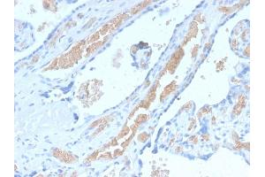 Formalin-fixed, paraffin-embedded human Pancreas stained with Spectrin alpha 1 Rabbit Recombinant Monoclonal Antibody (SPTA1/2939R). (Recombinant SPTA1 anticorps  (AA 356-475))
