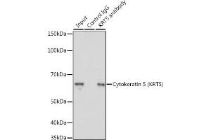 Immunoprecipitation analysis of 200 μg extracts of A-431 cells using 3 μg Cytokeratin 5 (Cytokeratin 5 (KRT5)) antibody (ABIN3016404, ABIN3016405, ABIN3016406 and ABIN6219743).