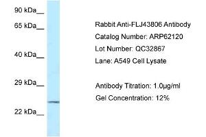 Western Blotting (WB) image for anti-Kazrin (KAZ) (C-Term) antibody (ABIN2774334) (Kazrin anticorps  (C-Term))