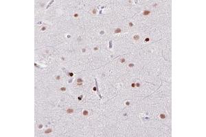 Immunohistochemical staining (Formalin-fixed paraffin-embedded sections) of human cerebral cortex with ZEB1 monoclonal antibody, clone CL0151  shows moderate to strong nuclear immunoreactivity in neuronal and glial cells. (ZEB1 anticorps)