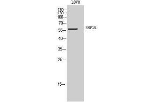 Western Blotting (WB) image for anti-Tripartite Motif Containing 38 (TRIM38) (Internal Region) antibody (ABIN3186824)