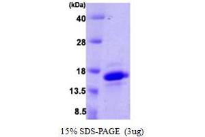 SDS-PAGE (SDS) image for Vesicle-Associated Membrane Protein 4 (VAMP4) (AA 1-115) protein (His tag) (ABIN666784) (VAMP4 Protein (AA 1-115) (His tag))