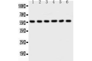 Observed bind size: 56KD (AKT2 anticorps  (C-Term))