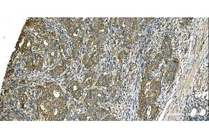 IHC analysis of Aspartate Aminotransferase/GOT1 using anti-Aspartate Aminotransferase/GOT1 antibody (ABIN7601883). (GOT1 anticorps  (AA 5-413))