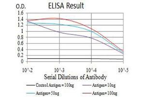 Black line: Control Antigen (100 ng),Purple line: Antigen (10 ng), Blue line: Antigen (50 ng), Red line:Antigen (100 ng)