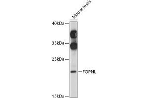 Western blot analysis of extracts of Mouse testis, using FOPNL antibody (ABIN7267173) at 1:1000 dilution. (FOPNL anticorps  (AA 20-100))