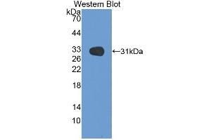 Western blot analysis of recombinant Rat MEP1b. (Meprin B anticorps  (AA 433-679))