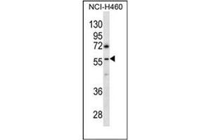 Western blot analysis of GBRR3 Antibody (N-term) in NCI-H460 cell line lysates (35ug/lane). (GBRR3 anticorps  (N-Term))